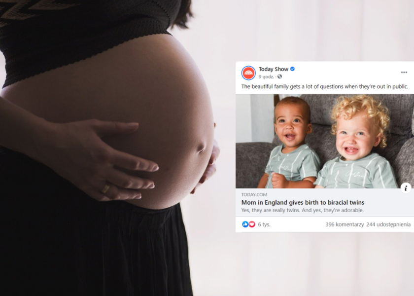 Urodziła dwurasowe bliźnięta. Szanse na to są niewielkie
